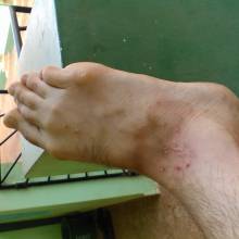 Mosquitos are jerks.