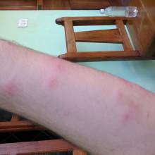 Mosquitos are jerks.